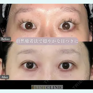 症例