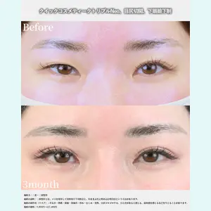 湘南美容クリニック 名古屋院 山本 高士医師の症例