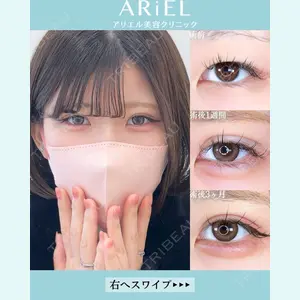 アリエル美容クリニック 大宮院 鈴木　桂介医師の症例