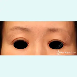 症例