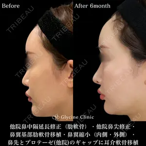 グリシーヌクリニック 藤本 雅史医師の症例