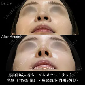 グリシーヌクリニック 藤本 雅史医師の症例