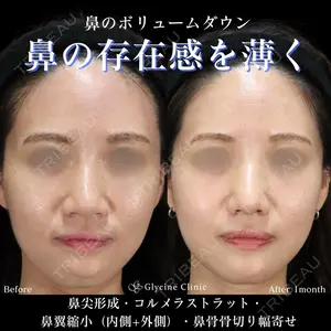 グリシーヌクリニック 藤本 雅史医師の症例