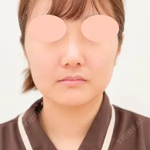 A CLINIC（エークリニック） 銀座院 山田 哲雄医師の症例