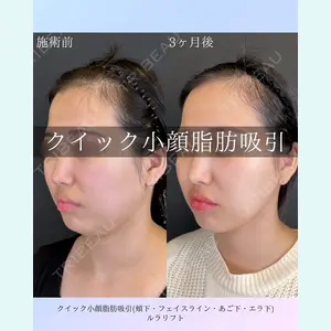 ルラ美容クリニック 札幌院 佐藤 雄紀医師の症例