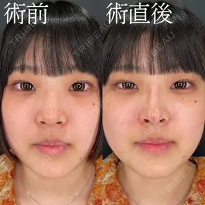 HAAB×DREAM BEAUTY CLINIC 大阪梅田院 柏木 太雅医師の症例