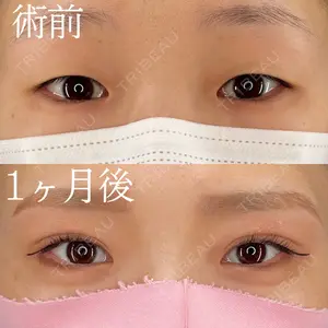 HAAB×DREAM BEAUTY CLINIC 大阪梅田院 柏木 太雅医師の症例