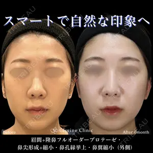 グリシーヌクリニック 藤本 雅史医師の症例