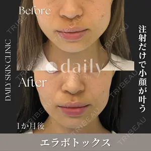 DAILY SKIN CLINIC 心斎橋院の症例