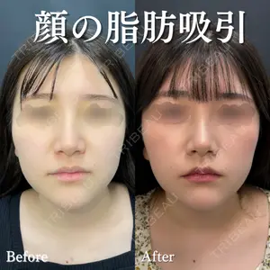 ルラ美容クリニック 渋谷本院 住友 沙織医師の症例