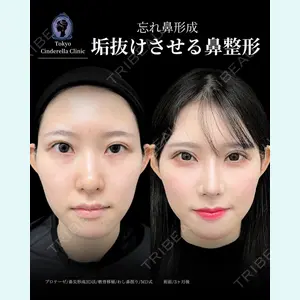 東京シンデレラ美容外科 新宿院 吉原 伯医師の症例