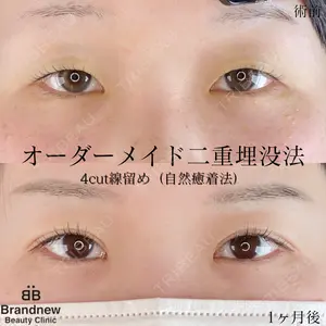 Brandnew Beauty Clinicの症例