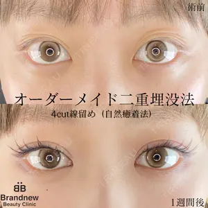 Brandnew Beauty Clinicの症例