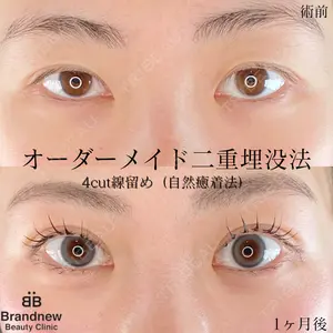 Brandnew Beauty Clinicの症例