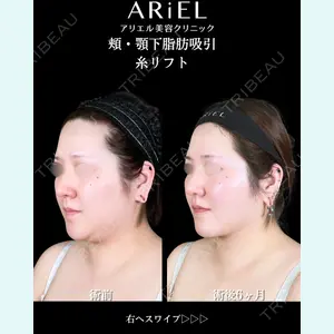 アリエル美容クリニック 大宮院 鈴木　桂介医師の症例