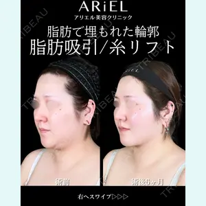 アリエル美容クリニック 大宮院 鈴木　桂介医師の症例