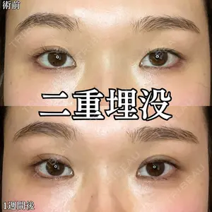 形成外科と美容外科のクリニック池袋 春日 航医師の症例