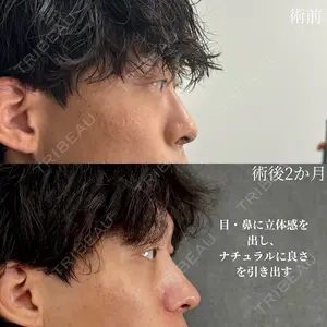 ネビュラクリニック 京都院 岸 大輔医師の症例