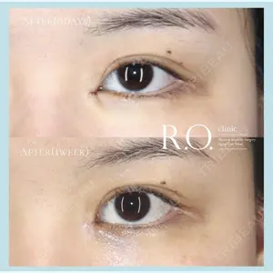 R.O.clinic 呂 秀彦医師の症例