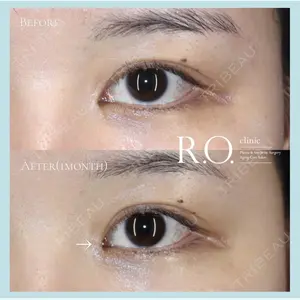 R.O.clinic 呂 秀彦医師の症例