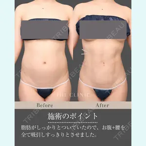 症例
