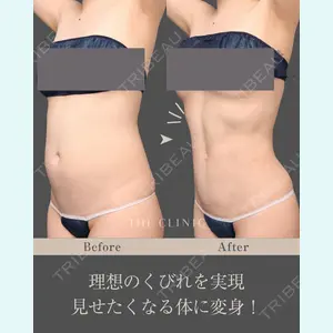 症例