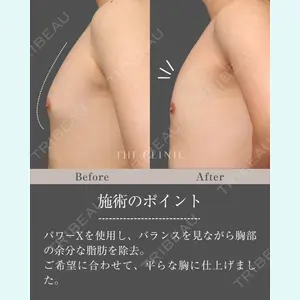 症例