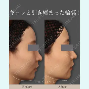 THE CLINIC（ザ・クリニック） 東京院の症例