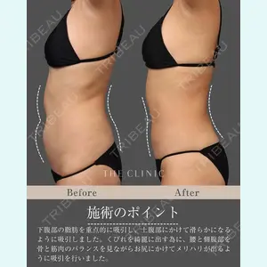 症例
