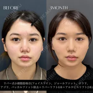 RIVER CLINIC（リバークリニック） 戸田 貴之医師の症例