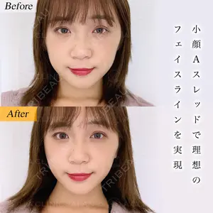 A CLINIC（エークリニック） 横浜院 柴田 貴志医師の症例