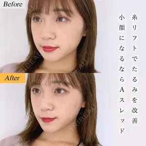 A CLINIC（エークリニック） 横浜院 柴田 貴志医師の症例