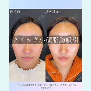 ルラ美容クリニック 札幌院 佐藤 雄紀医師の症例