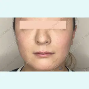 Original Beauty Clinic GINZA 佐藤玲史医師の症例