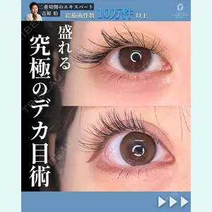 東京シンデレラ美容外科 新宿院 吉原 伯医師の症例