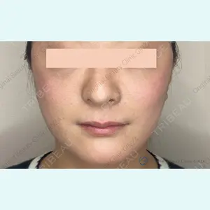 Original Beauty Clinic GINZA 佐藤玲史医師の症例