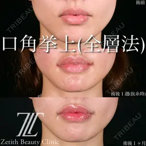 Zetith Beauty Clinic 池袋院 北村 翔医師の症例