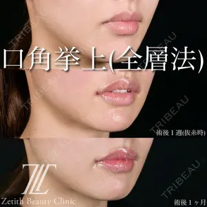 Zetith Beauty Clinic 池袋院 北村 翔医師の症例