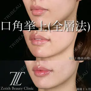 Zetith Beauty Clinic 池袋院 北村 翔医師の症例