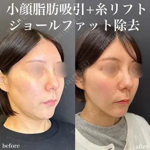 ルラ美容クリニック 名古屋栄院 関戸 優医師の症例