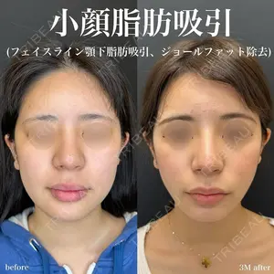 ルラ美容クリニック 名古屋栄院 関戸 優医師の症例