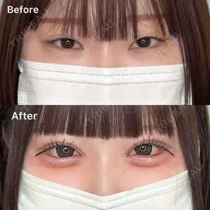 TCB東京中央美容外科 宇都宮院 岡本 卓也医師の症例
