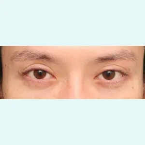 プリモ麻布十番クリニック 大場教弘医師の症例