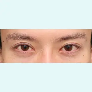 プリモ麻布十番クリニック 大場教弘医師の症例