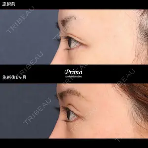 プリモ麻布十番クリニック 大場教弘医師の症例