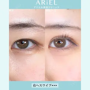 アリエル美容クリニック 大宮院の症例