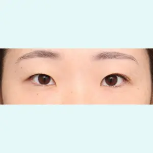 症例