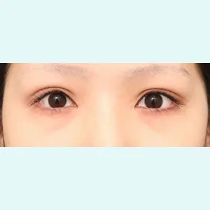 症例