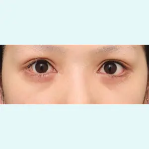 症例