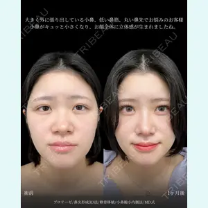 東京シンデレラ美容外科 新宿院 吉原 伯医師の症例